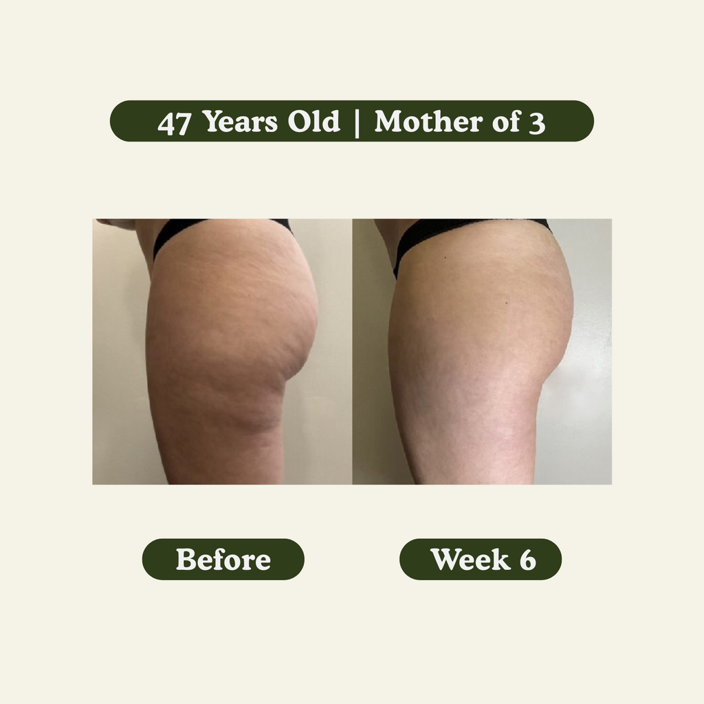 Anti-Cellulite Massage Oil